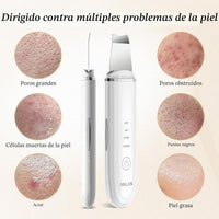 ANLAN Peeling Ultrasónico Facial Skin Scrubber Exfoliación Limpiador De Poros Para Limpieza Y Cuidado (Blanco)