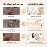 ANLAN Peeling Ultrasónico Facial Skin Scrubber Exfoliación Limpiador De Poros Para Limpieza Y Cuidado (Blanco)